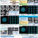 特発性正常圧水頭症と進行性核上性麻痺 ポスター最終案